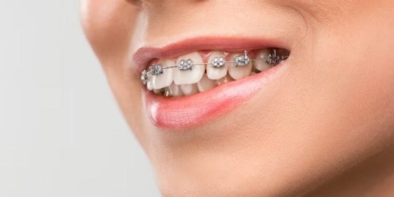 Orthodontics